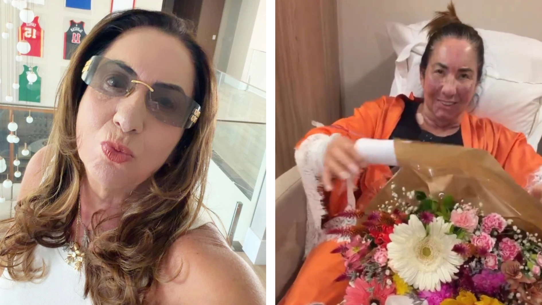 Mae de Virginia faz procedimentos esteticos e e lembrada.webp