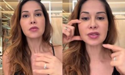 Maira Cardi busca cirurgia para remover procedimento do rosto Abrir