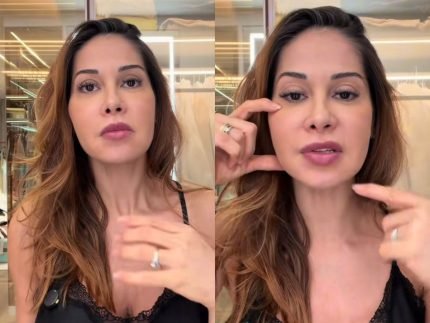 Maira Cardi busca cirurgia para remover procedimento do rosto Abrir
