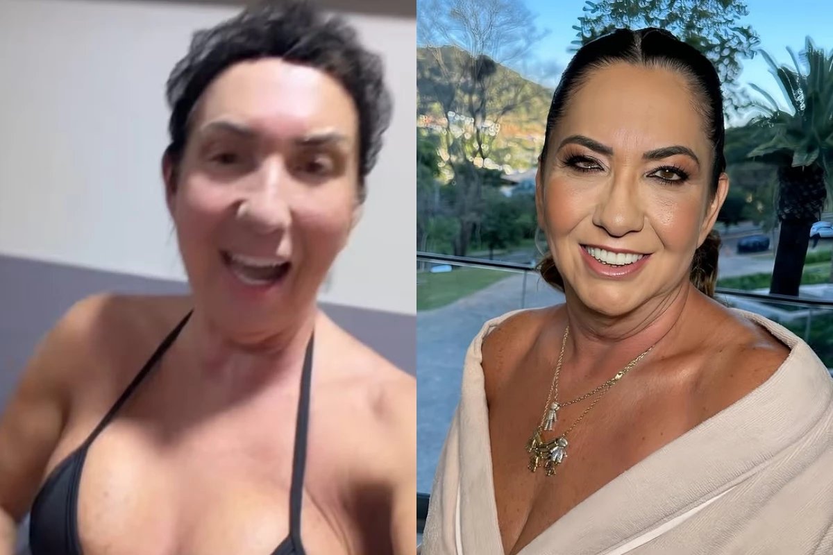 Margareth Serrao mostra o resultado do combo de cirurgias plasticas