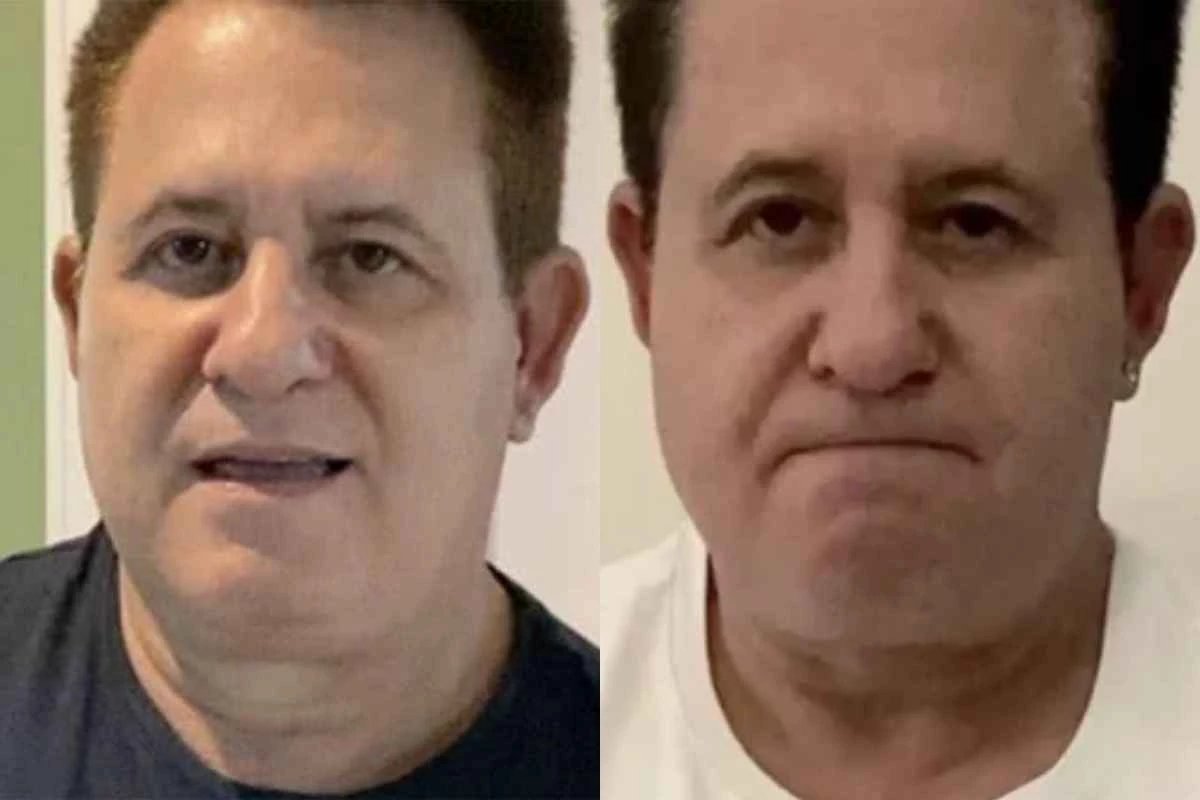 Marrone vai para a mesa de cirurgia e informacao acaba