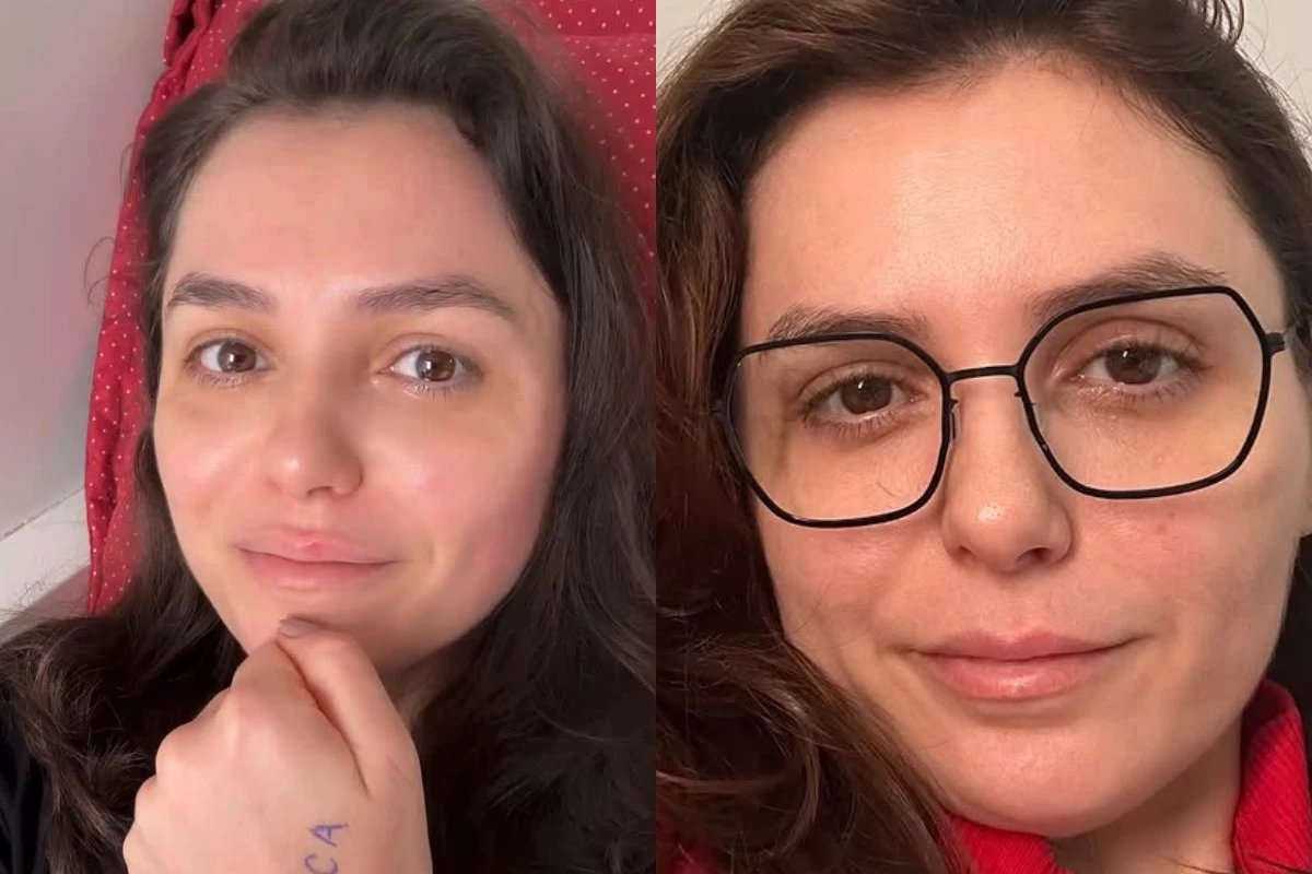 Medicos tomam decisao sobre Monica Iozzi apresentadora esteve internada com