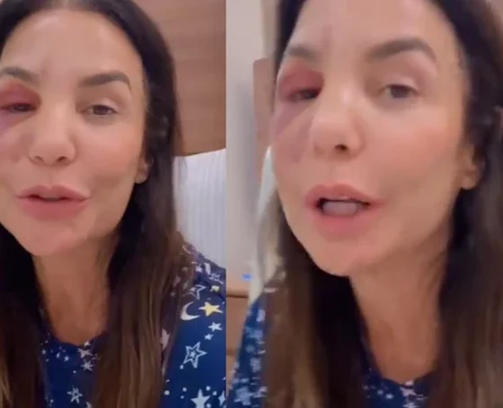 O que aconteceu com Ivete Sangalo Cantora quebra dois.webp