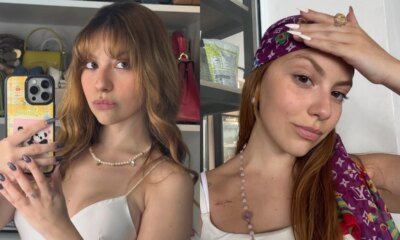 Tratamento ‘vermelho contra o cancer de mama da neta de