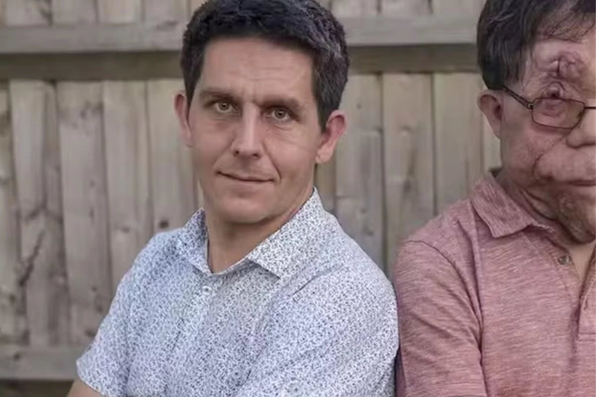 Tudo sobre Adam Pearson ator com Neurofibromatose uma doenca genetica