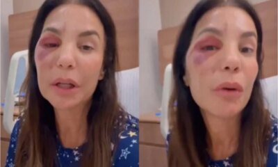 Video Ivete Sangalo revela que sente dormencia no rosto apos
