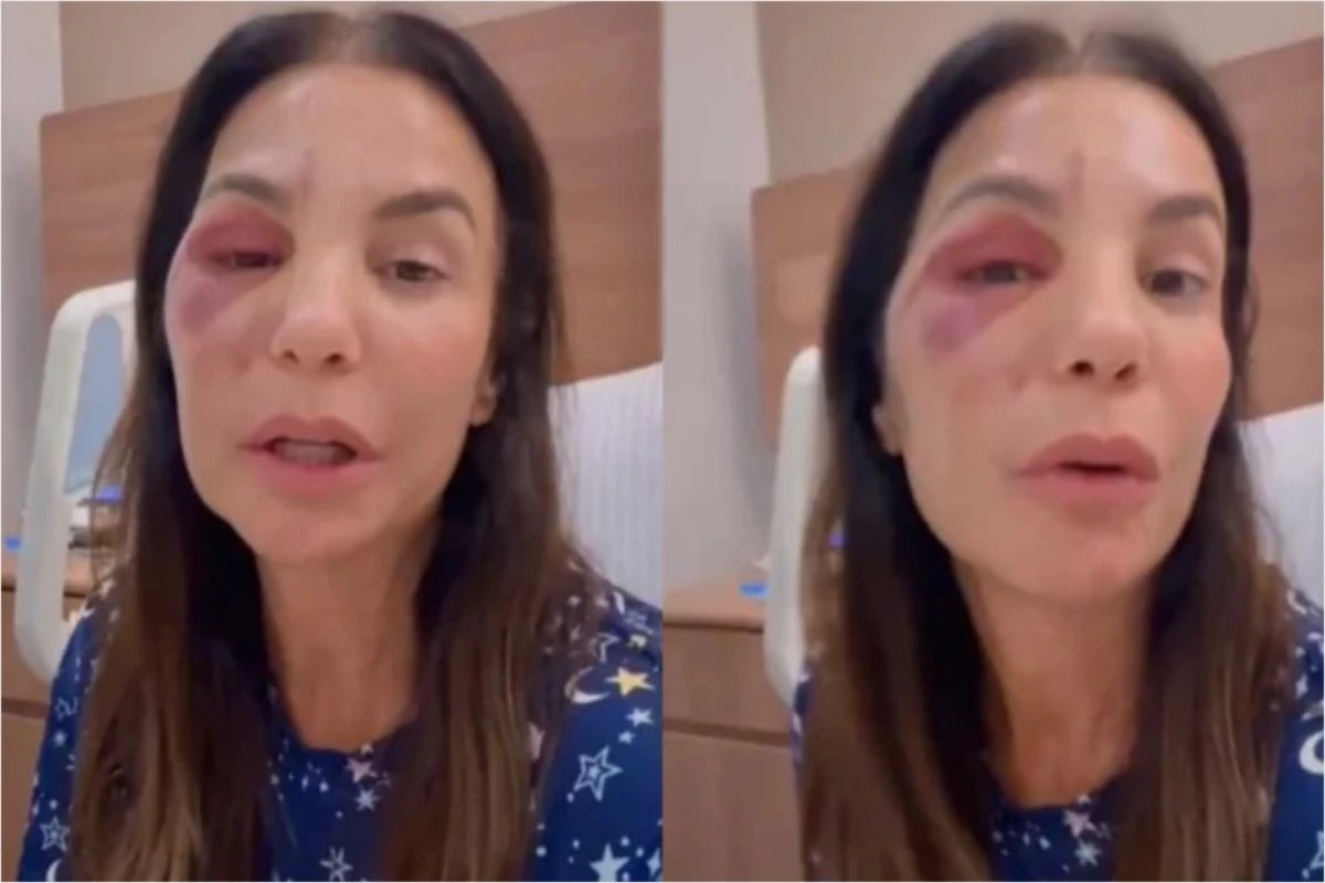 Video Ivete Sangalo revela que sente dormencia no rosto apos