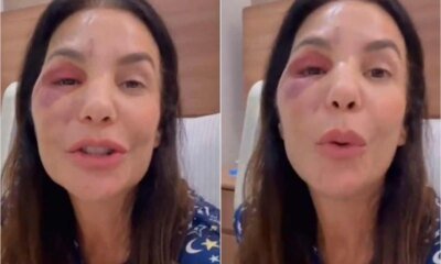 ‘Eu poderia ter batido a minha cabeca em algum lugar