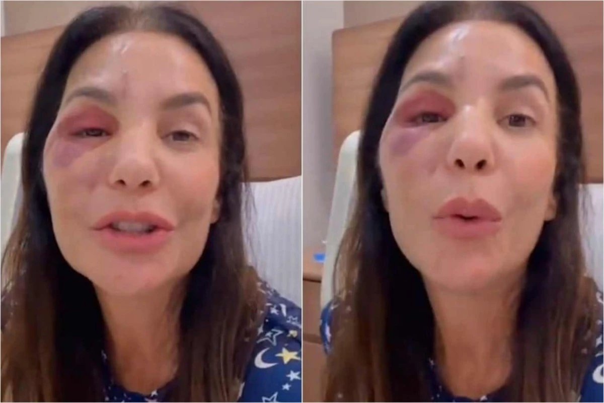 ‘Eu poderia ter batido a minha cabeca em algum lugar