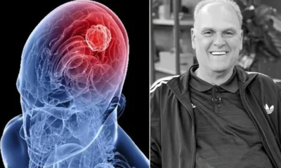 A doenca silenciosa que Oscar Schmidt enfrentava desde 2011.webp