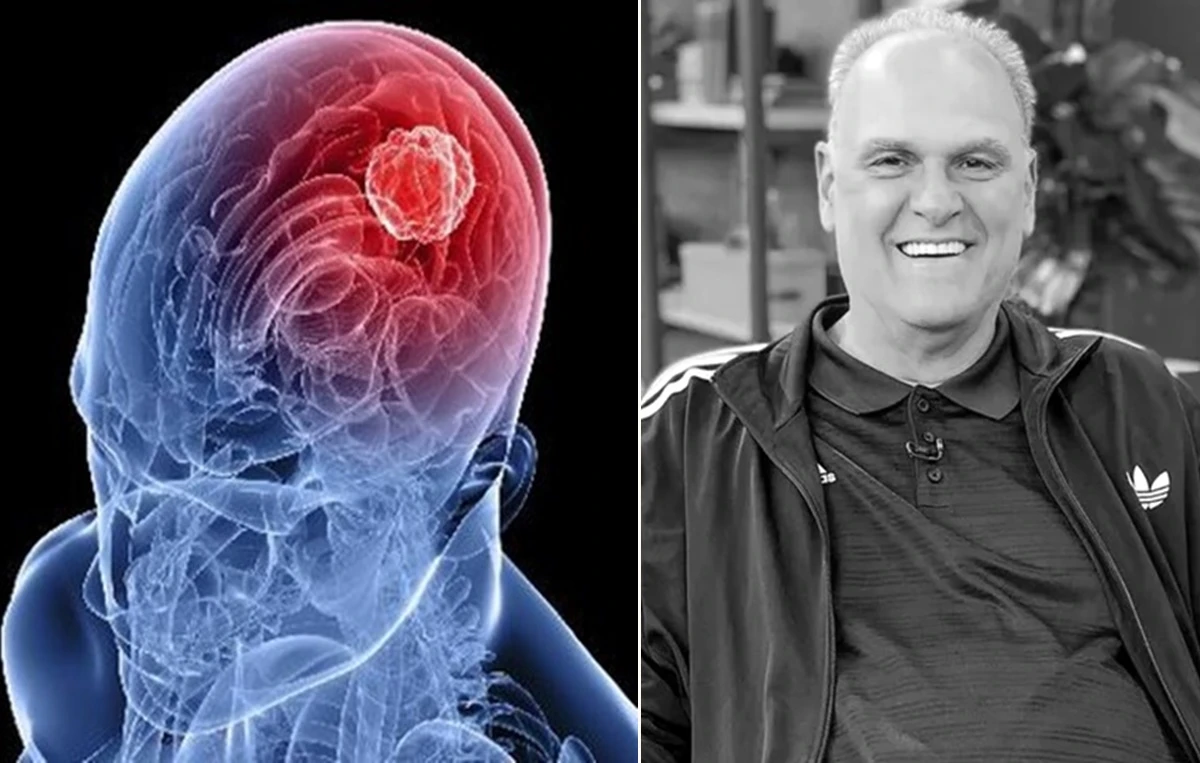 A doenca silenciosa que Oscar Schmidt enfrentava desde 2011.webp