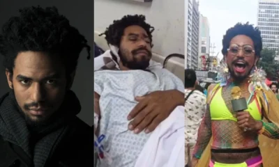 Ator e internado apos ser espancado durante ataque homofobico.webp