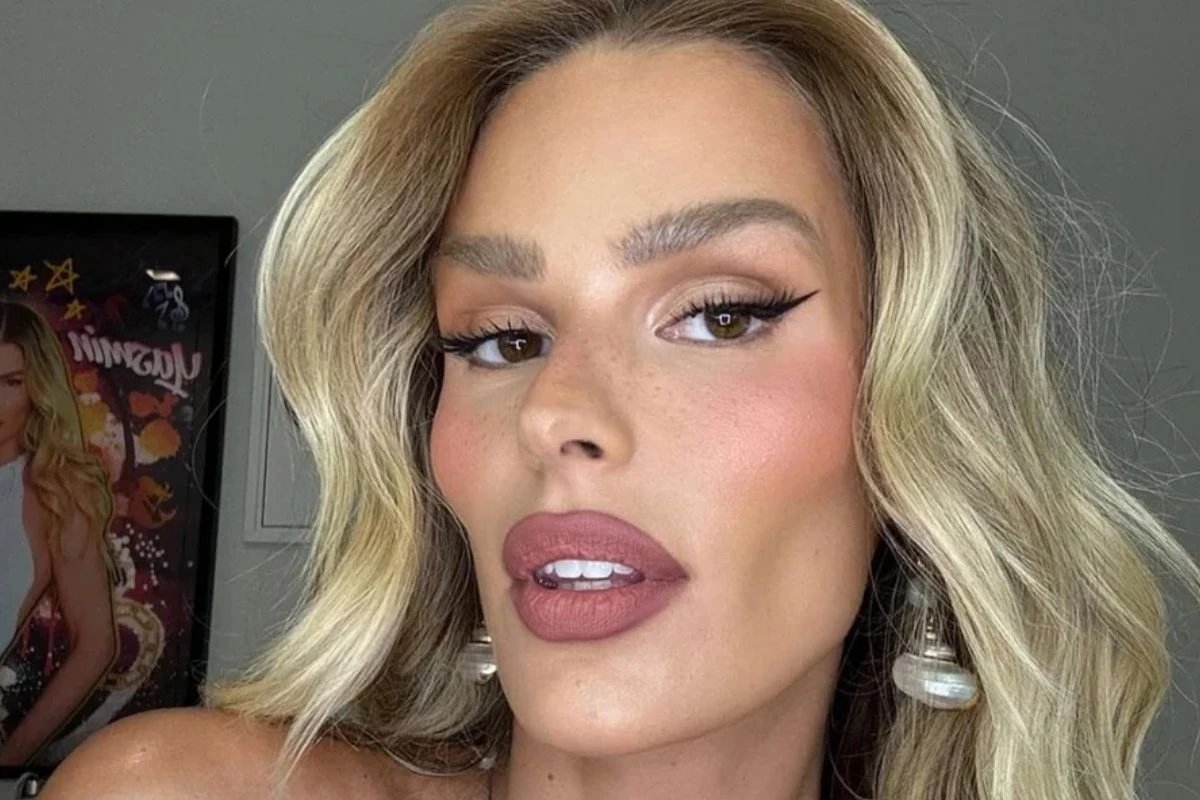 Diagnosticada com lipedema Yasmin Brunet perde 25 kg e mostra