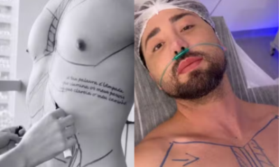 Eu sou do centro cirurgico Rico Melquiades detalha novos procedimentos