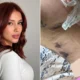 Influencer afirma ter sido deformada por clinica estetica.webp