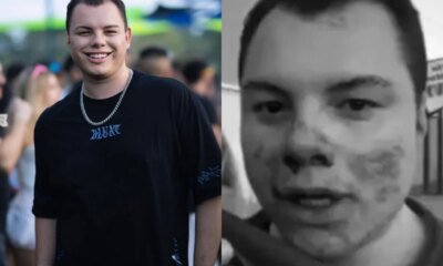 Influenciador agredido grava video antes de entrar em coma acorda