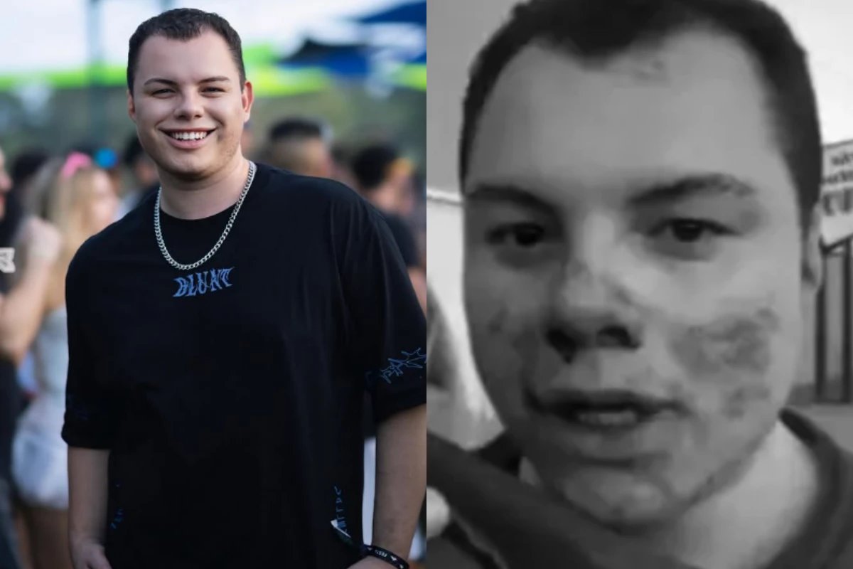 Influenciador agredido grava video antes de entrar em coma acorda