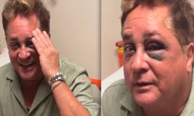 Leonardo sofre queda e vai parar em hospital imagens mostram