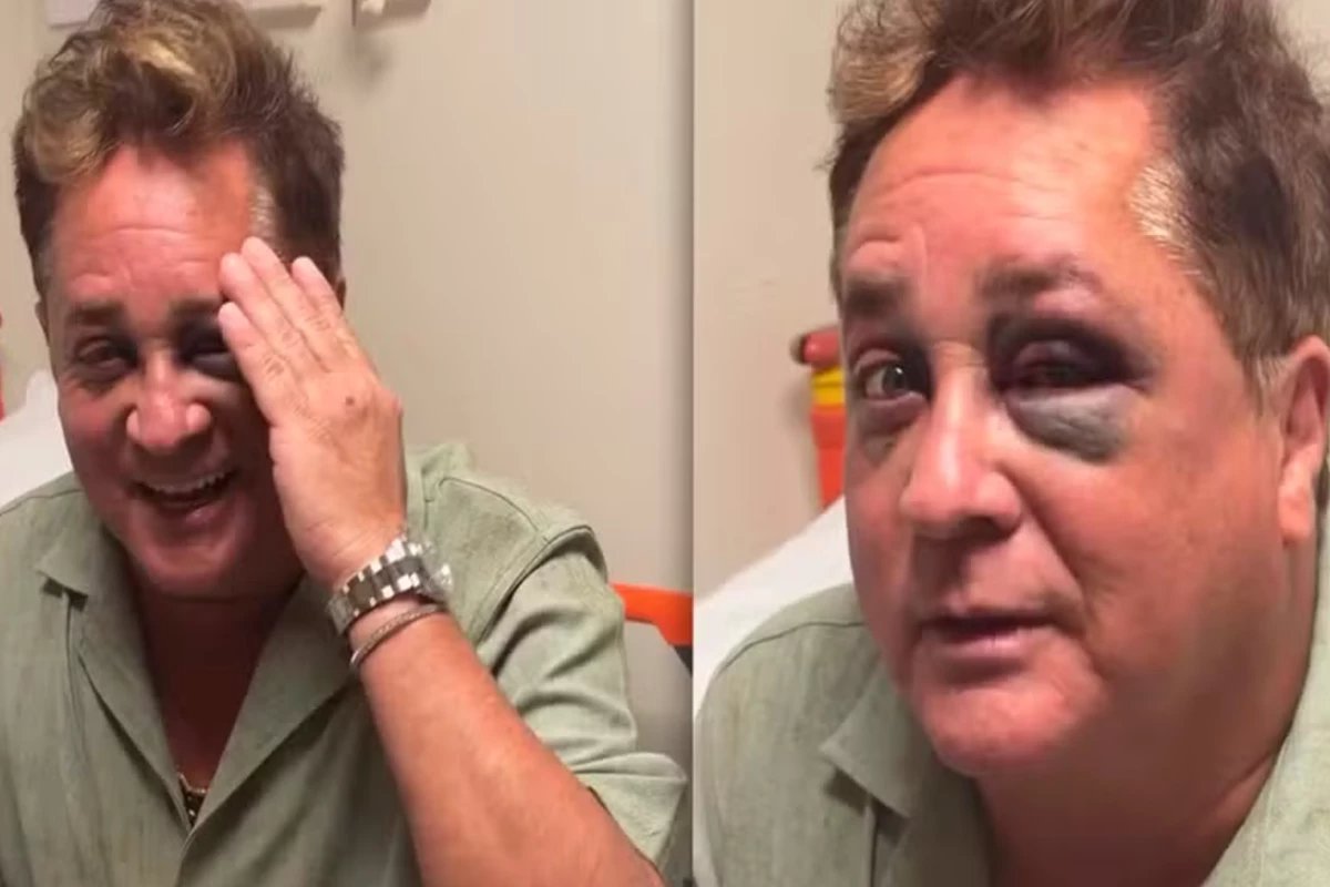 Leonardo sofre queda e vai parar em hospital imagens mostram