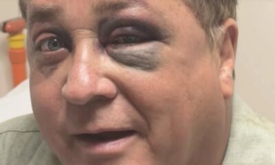 Poliana Rocha desabafa apos Leonardo aparecer com olho roxo susto