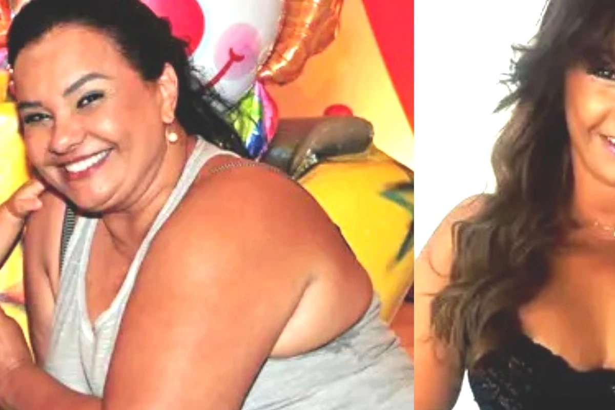 Solange Couto revela procedimentos ‘do ombro ao joelho apos eliminacao