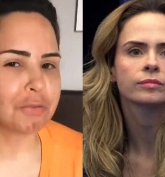 Video de Ana Paula antes de procedimento estetico cai na