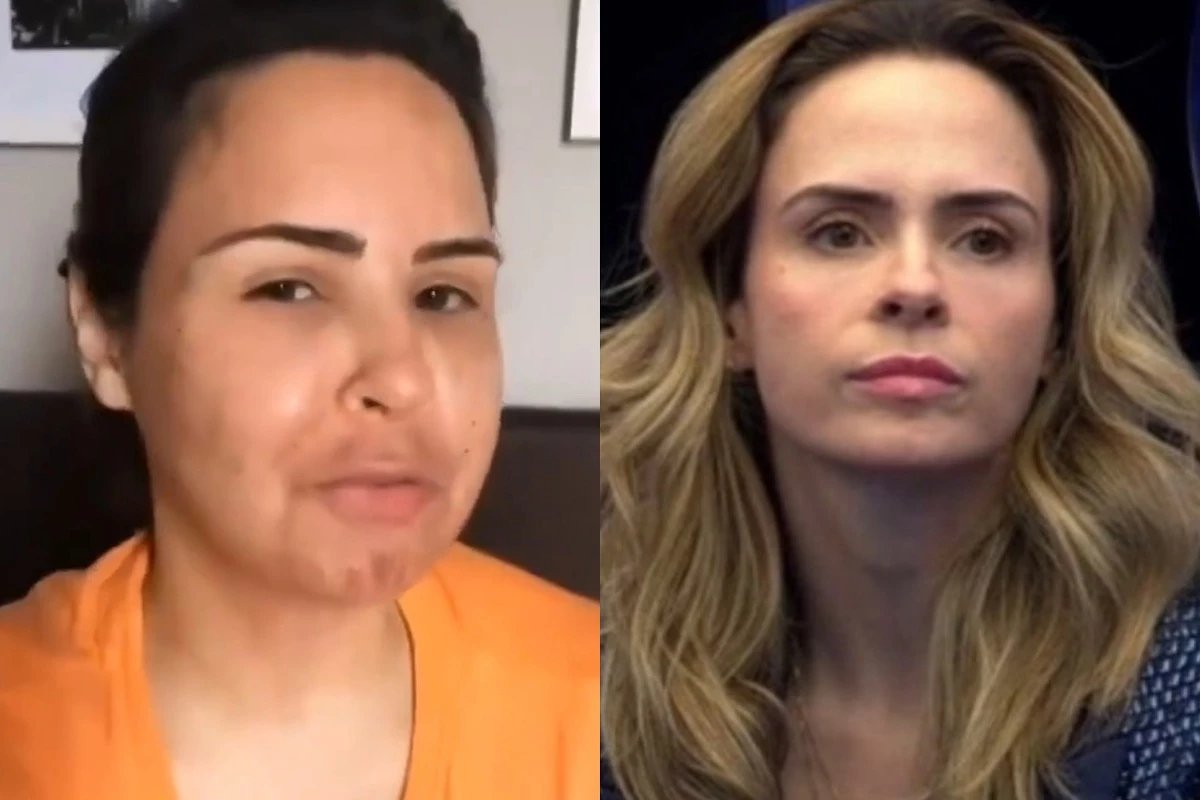 Video de Ana Paula antes de procedimento estetico cai na
