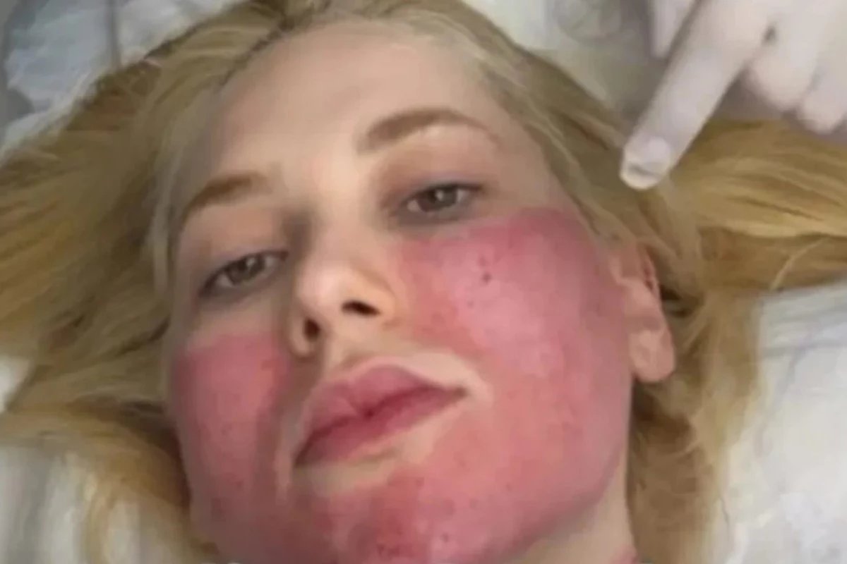 Virginia Fonseca passa dos limites com laser intenso e acende