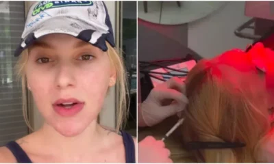 Virginia revela diagnostico de alopecia areata e faz desabafo.webp