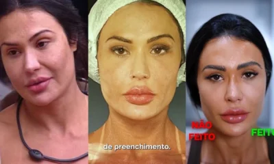 veja ex BBBs que reverteram procedimentos.webp