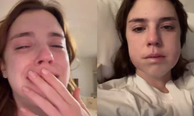 Alice Wegmann mostra perrengue apos tirar sisos Desarmonizacao.webp
