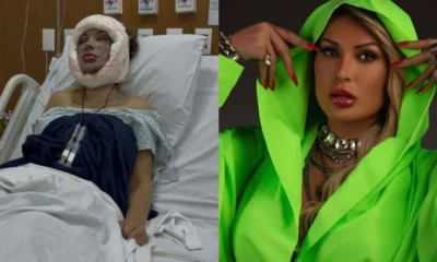 Andressa Urach faz nova cirurgia e afirma que tera.webp