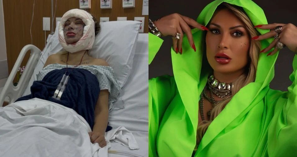 Andressa Urach faz nova cirurgia e afirma que tera.webp
