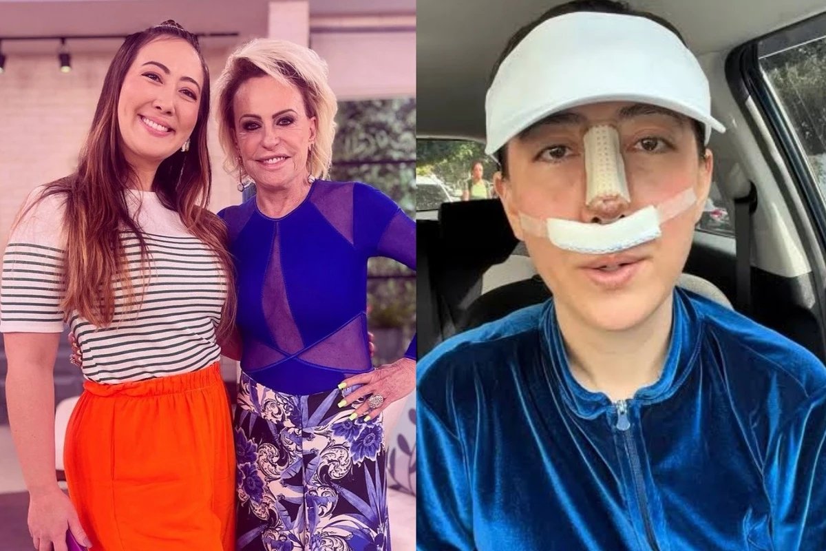 Apos quase perder o nariz reporter do Mais Voce faz