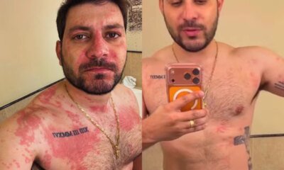 Caio Afiune do BBB21 vai parar no hospital e atualiza