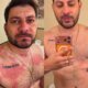 Caio Afiune do BBB21 vai parar no hospital e atualiza