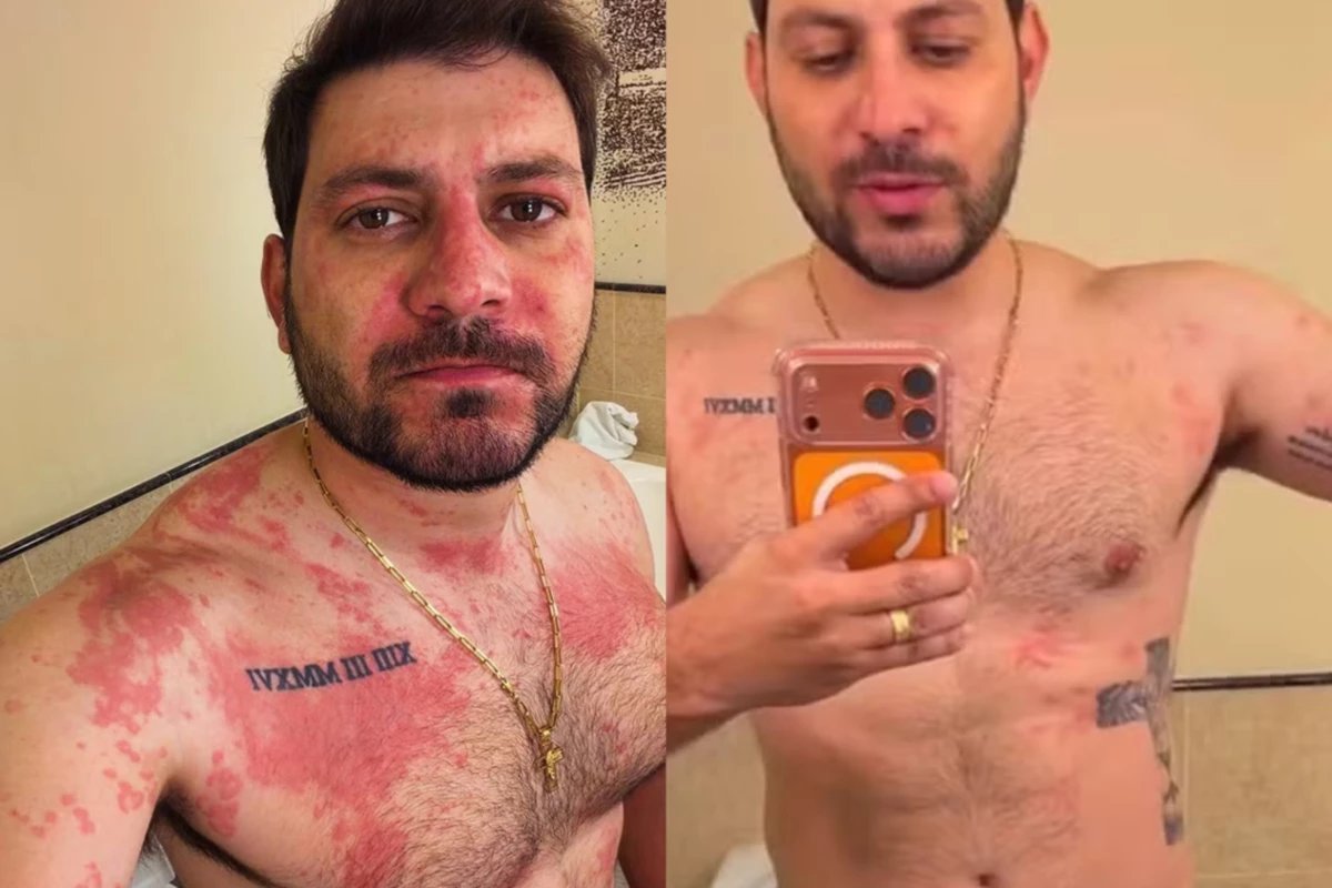 Caio Afiune do BBB21 vai parar no hospital e atualiza