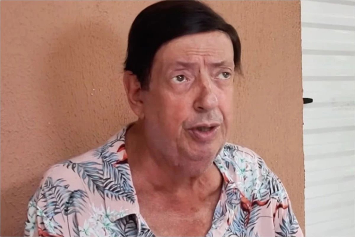 Estado de saude do ator Marcos Oliveira e atualizado apos