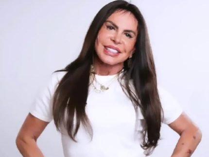 Gretchen quebra tabu e revela plastica intima apos emagrecer Sem