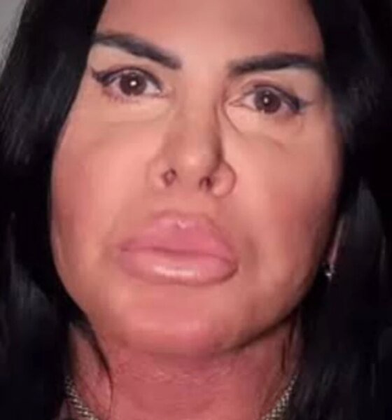 Gretchen vem a publico e expoe diagnostico que escondeu do