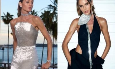 Izabel Goulart surge com rosto diferente apos suposto procedimento e