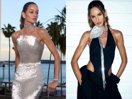 Izabel Goulart surge com rosto diferente apos suposto procedimento e