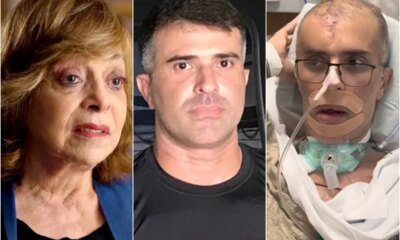 Morte de policial que perdeu 40 do cranio ao ser