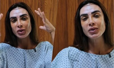 Nicole Bahls passa por transplante e medico declara ‘O objetivo