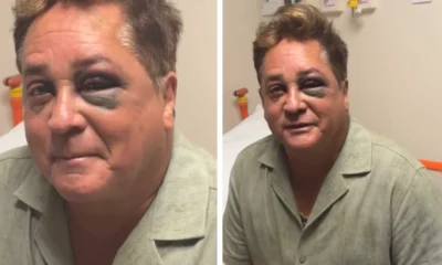 Poliana mostra recuperacao de Leonardo apos acidente durante pesca.webp