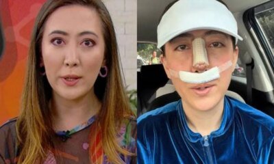 Vivendo um verdadeiro drama reporter do Mais Voce surge irreconhecivel