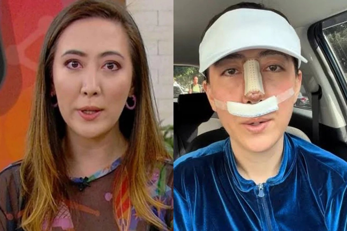 Vivendo um verdadeiro drama reporter do Mais Voce surge irreconhecivel