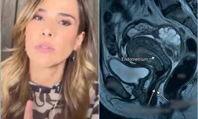 Wanessa Camargo aos 43 anos fala sobre doenca comum a