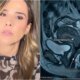 Wanessa Camargo aos 43 anos fala sobre doenca comum a