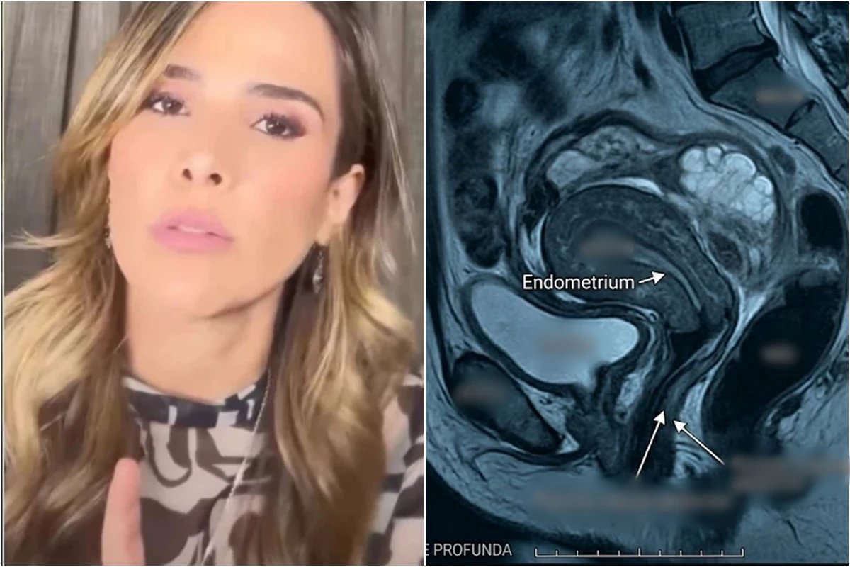 Wanessa Camargo aos 43 anos fala sobre doenca comum a